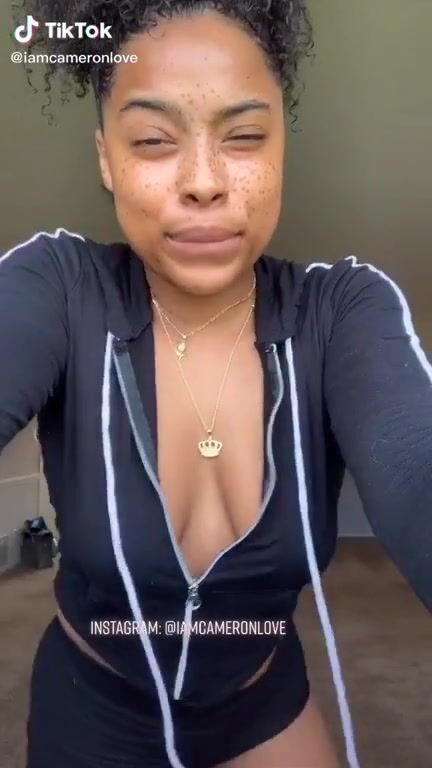 Freckles and nip slip