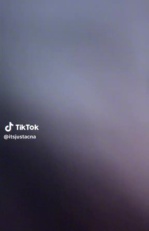 Closeup leg spread flash panties @itsjustacna Sarah????????