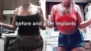 Sexy TikTok Girls: New tits ♥️♥️♥️♥️♥️♥️ #4