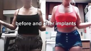 Sexy TikTok Girls: New tits ♥️♥️♥️♥️♥️♥️ #3